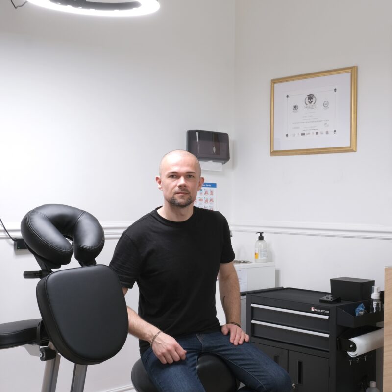 Scalp Micropigmentation and Laser Tattoo Removal and 3D Areola Tattoo, Scotland, Kirkcaldy, Edinburgh, Glasgow, Canterbury, Kent, England