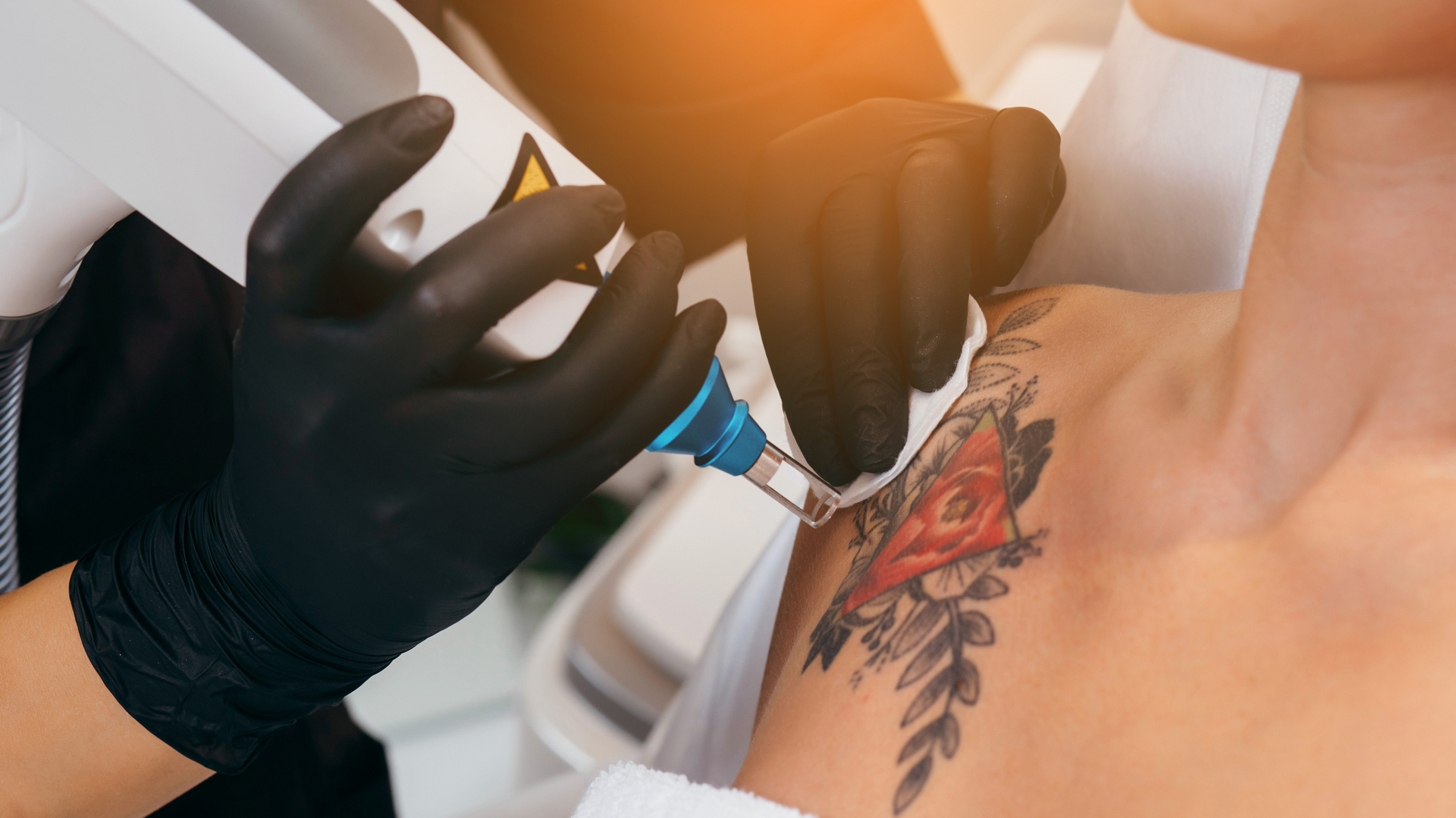 Laser Tattoo Removal in Canterbury Kent by SMP Atelier